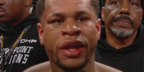 did devin break his jaw|Ryan Garcia claims he broke Devin Haney's JAW during his stunning up.